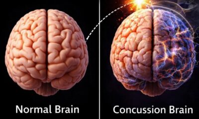 How Human Brain Delicate